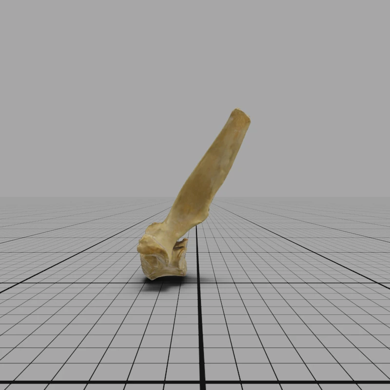 Thoracic Vertebra 1